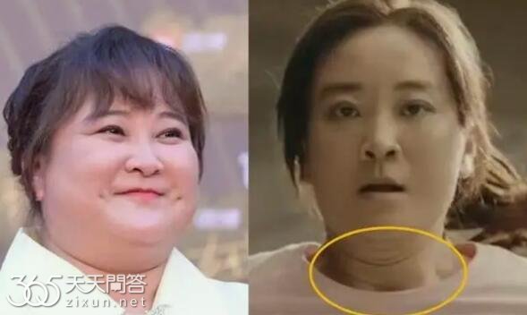 贾玲暴瘦100斤怎么回事