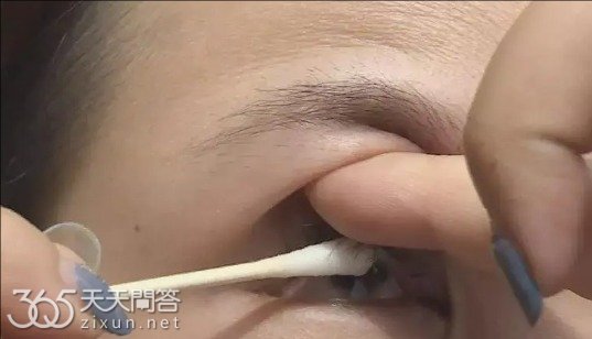 眼睛进异物了怎么办