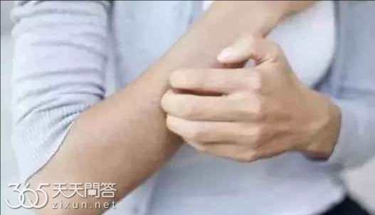 蚊子咬了怎么消肿止痒最快